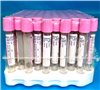 BD (Becton Dickinson) Venous Blood Collection Whole Blood Tube Vacutainer® 367899 938904
