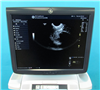GE Ultrasound Logiq E9 939613