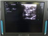 Zonare Ultrasound ZS3 942339