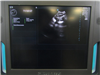 Zonare Ultrasound ZS3 942340