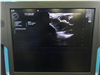 Zonare Ultrasound ZS3 942340