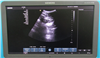 Siemens Ultrasound ACUSON X700 942369