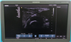 Siemens Ultrasound ACUSON X700 942369