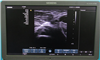Siemens Ultrasound ACUSON X700 942369