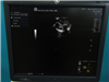 GE Ultrasound Logiq E9 942378