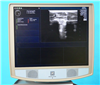 Zonare Convertible Ultrasound Z.One Ultra 945248