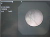 Olympus Bronchoscope BF-XP160F Evis Exera 945873