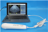 Interson Bladder Scanner 950102