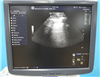 GE Ultrasound Logiq E9 950110