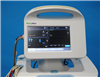 Welch Allyn Vital Signs Monitor 6000 Series 951724