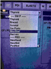 GE Ultrasound Logiq P5 954337