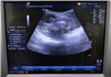 GE Ultrasound Logiq P5 954337