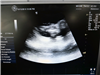GE Ultrasound Logiq e 954649